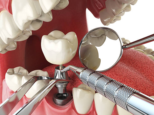 Best Holiday Emergency Dentist in Millersport, OH